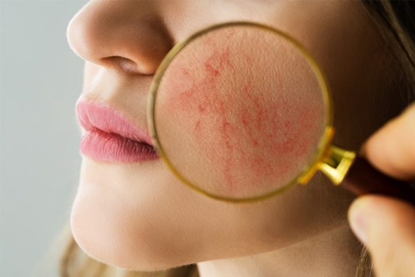 Skin problems