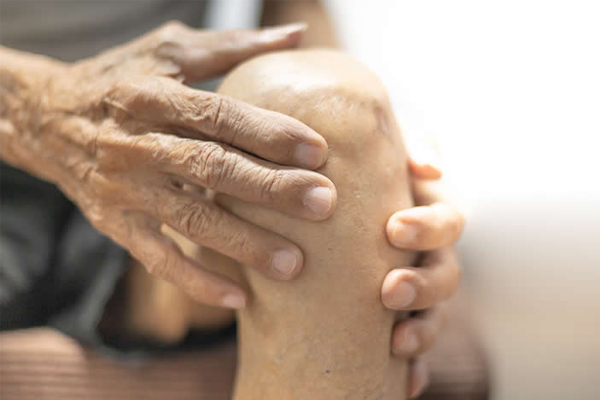 Arthritis