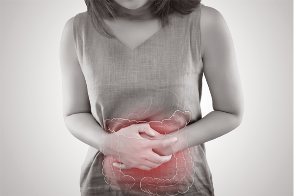 Irritable Bowel Syndrome (IBS)