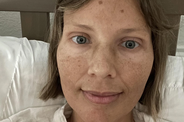 Addison’s Disease