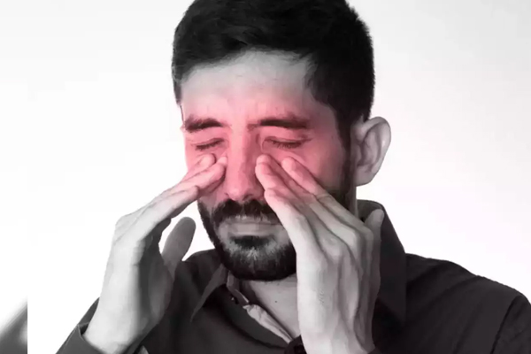 Sinusitis