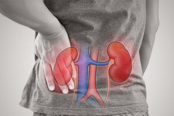 Renal Failure