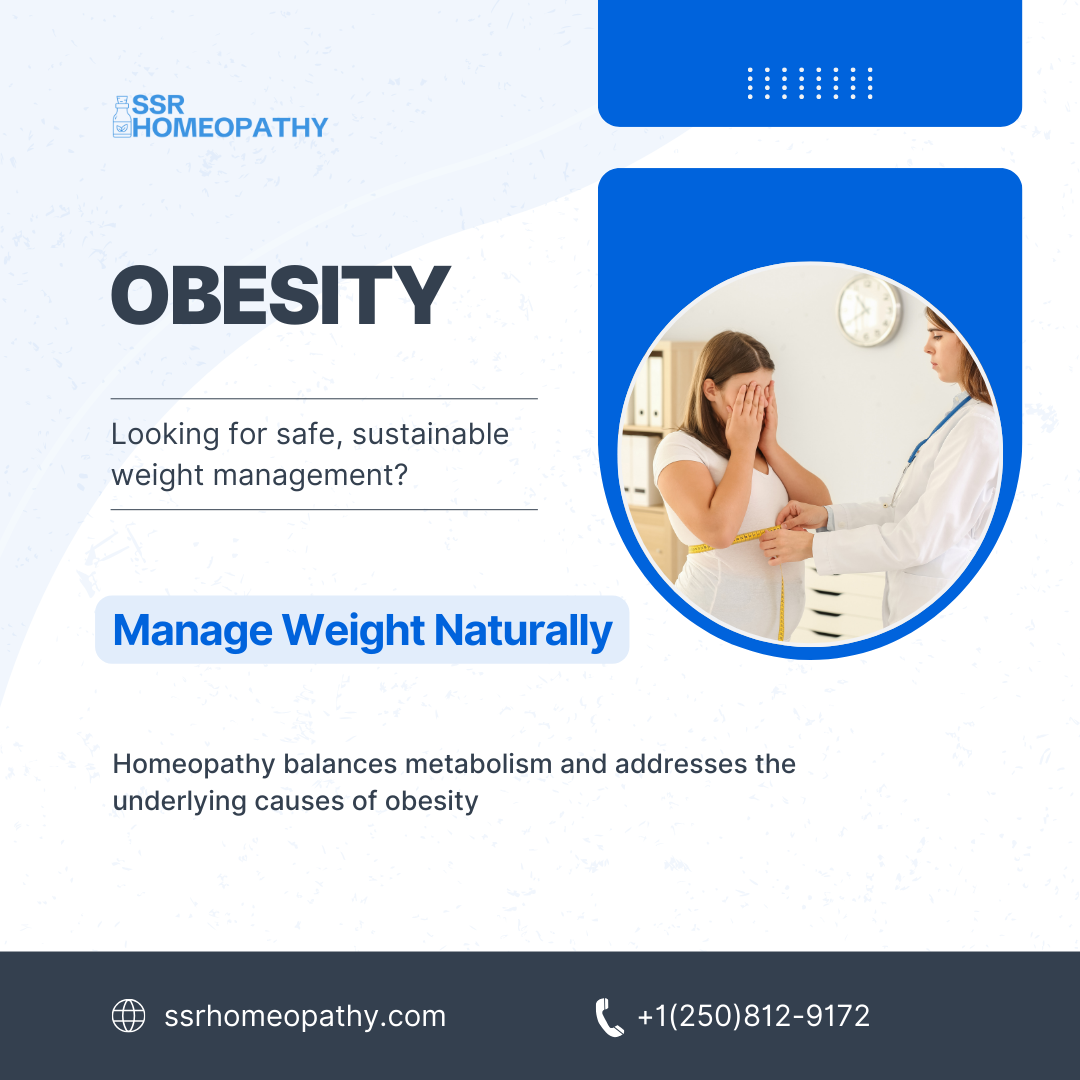 Obesity, lifestyle and homeopathic support