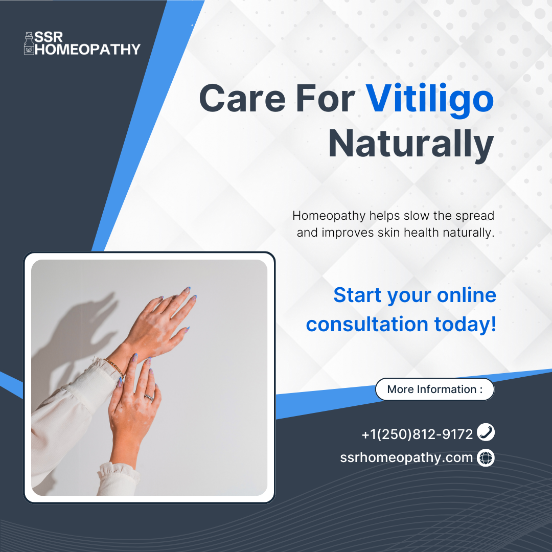 Post about vitiligo and skin support with homeopathy